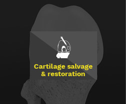 Cartilage service