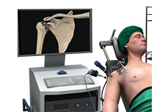 Minimally Invasive Shoulder Joint Replacement